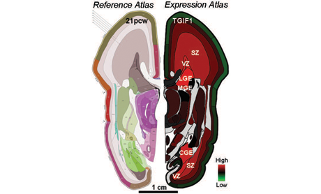 The recently created BrainSpan Atlas of the Developing Human Brain incorporates gene activity or expression (right) along with anatomical reference atlases (left) and neuroimaging data (not shown) of the mid-gestational human brain. In this figure, the location and expression level of the gene TGIF1 is shown of a brain from 21 weeks post-conception. Knowledge of where and when particular genes are expressed will facilitate research surrounding human brain development and disease.