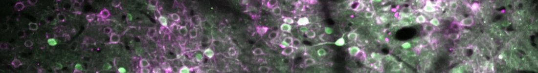 Two-photon microscopy image of neurons colored green and magenta. Courtesy of Histed Lab.