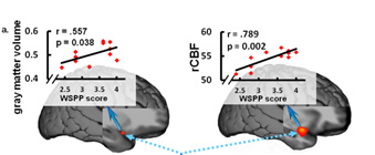 insula abnormalities predict personality