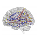 Brain scan showing connectivity related to repetitive behaviors