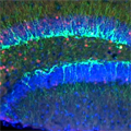 new neurons born in adult dentate gyrus